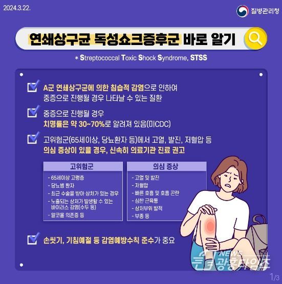 안산시, 연쇄상구균 독성쇼크증후군(STSS) 주의·예방 당부