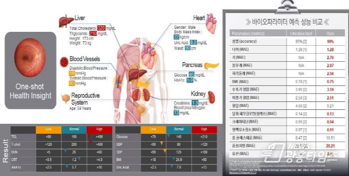 안저영상 기반 바이오 파라메타 예측 모델 및 성능